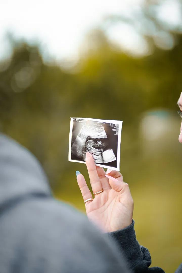 pregnancy-slider 78